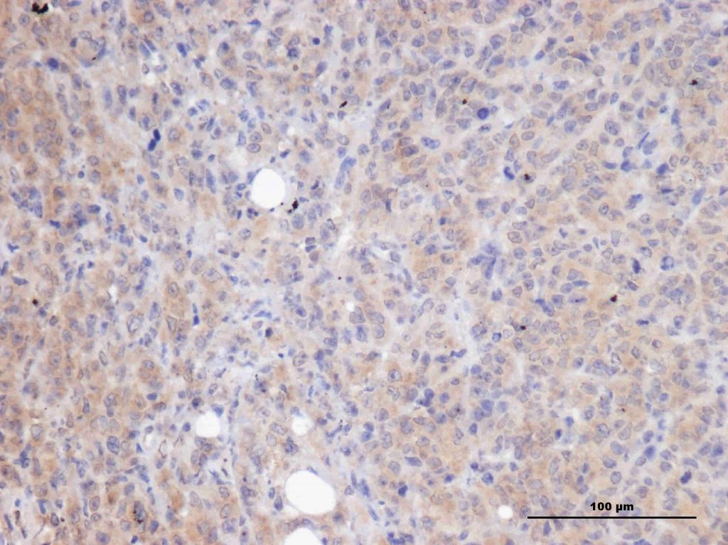 免疫组化结果求解!