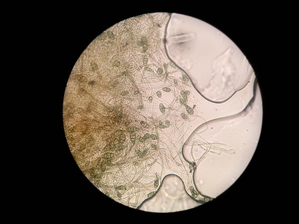 真菌形态鉴定的问题