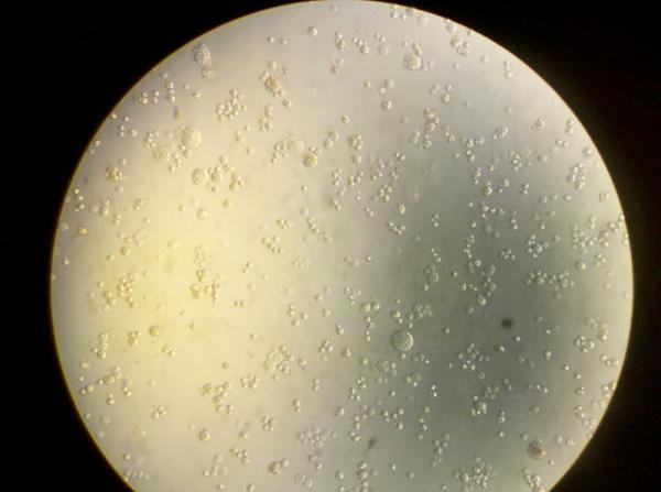 细胞抱团和细胞染菌怎么区别啊