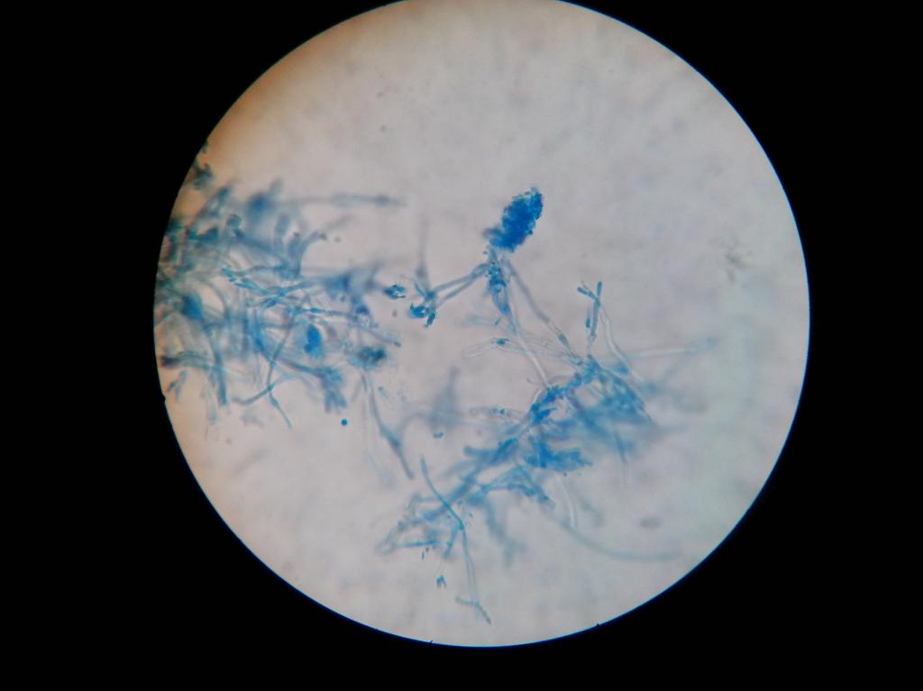 毛霉显微镜下的图片图片