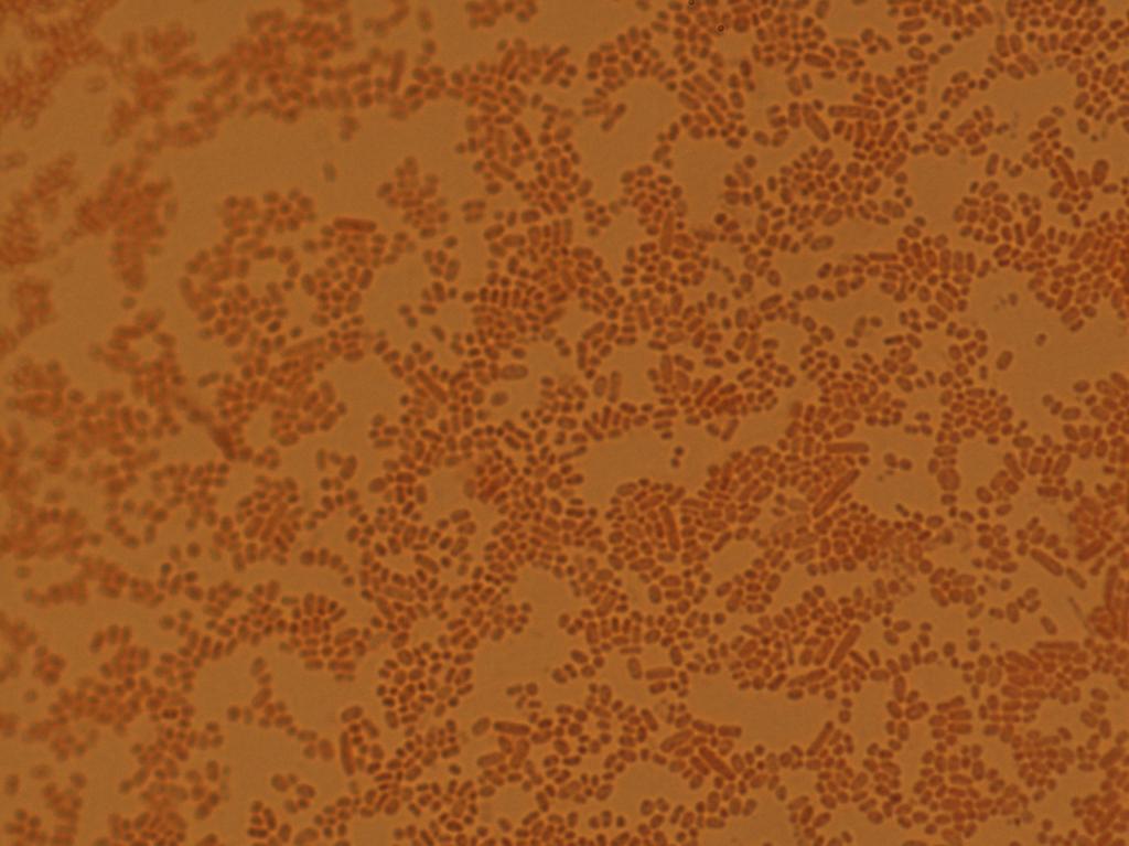 大肠杆菌显微镜油镜图片